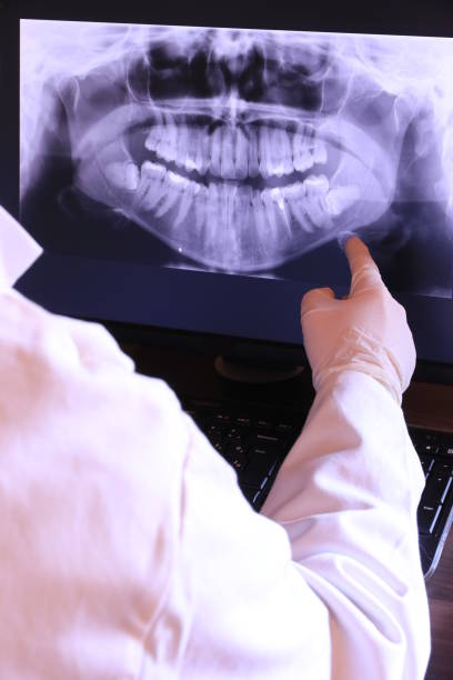 Best Emergency Wisdom Tooth Extraction in Wallburg, NC